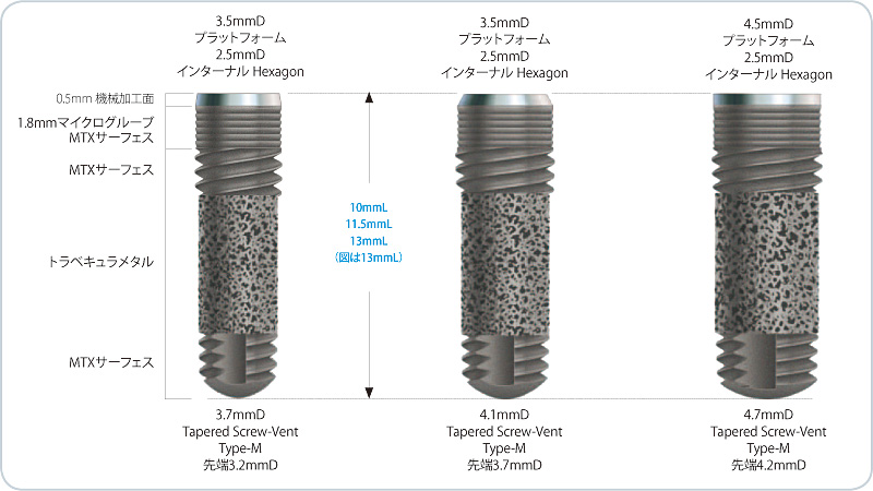 Trabecular Metal™ Dental Implant Type-M